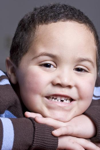 Young boy aged between 3-5 years old smiling with a missing tooth.